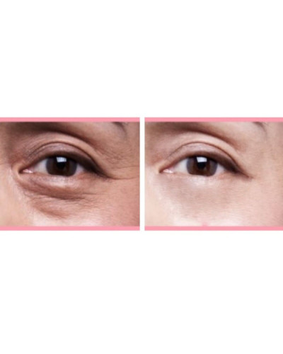 Капсульный крем CU SKIN Dr. Solution Capsule Tone-Up Eye Cream для зоны вокруг глаз