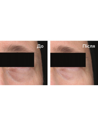 Зволожувальна антистрес-сироватка з кріоефектом — INSTYTUTUM CRYOshot Hydrating Serum 30 мл