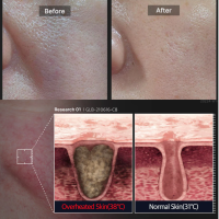 Medicube Zero Pore Cooling Mask тканинна охолоджуюча маска для звуження пор 1 шт