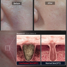 Medicube Zero Pore Cooling Mask тканевая охлаждающая маска для сужения пор 1 шт