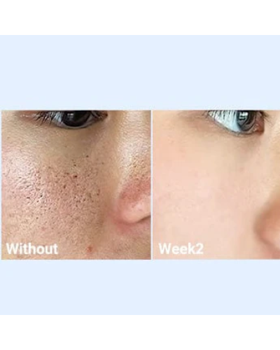 Корейская сыворотка с кислотами Medicube Zero Pore One Day Serum для пор и себума 30 мл