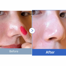 Medicube Zero Pore Pad 2.0 корейські тонер-пади для пор та себуму 70 шт