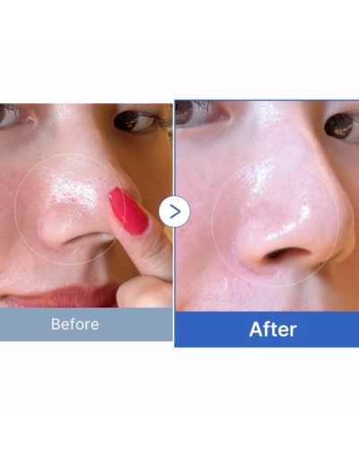 Корейські тонер-пади Medicube Zero Pore Pad 2.0 для очищення пор і себуму 70 шт