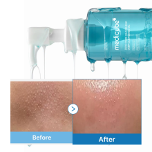 Medicube Zero Pore Blackhead Deep Cleansing Oil корейское гидрофильное масло для очищения пор 205 мл