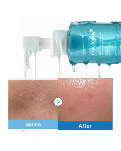 Корейська гідрофільна олія Medicube Zero Pore Blackhead Deep Cleansing Oil для чорних цяток та себуму 205 мл