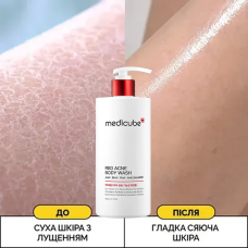 Medicube Red Acne Body Wash корейский противовоспалительный гель для душа с кислотами против акне 400 мл