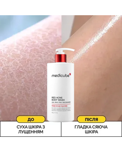 Корейський гель для душу проти акне Medicube Red Acne Body Wash з саліциловою кислотою для очищення та від висипань 400 мл