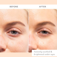 Patchology Skin Remedy Soothing Eye Gel — Успокаивающие патчи для кожи вокруг глаз набор 5 шт