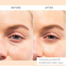 Patchology Skin Remedy Soothing Eye Gel — Успокаивающие патчи для кожи вокруг глаз набор 5 шт