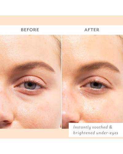 Успокаивающие патчи для кожи вокруг глаз — Patchology Skin Remedy Soothing Eye Gel