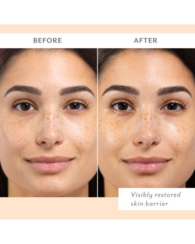 Успокаивающая маска для лица — Patchology Skin Remedy Barrier-Boosting Sheet Mask