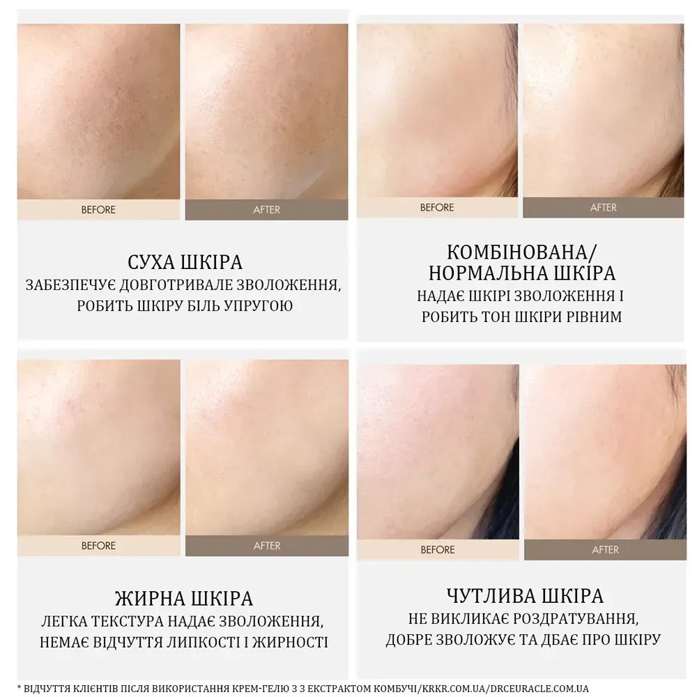 Dr.Ceuracle Vegan Kombucha Tea Gel Cream  Веганський крем-гель з екстрактом комбучі